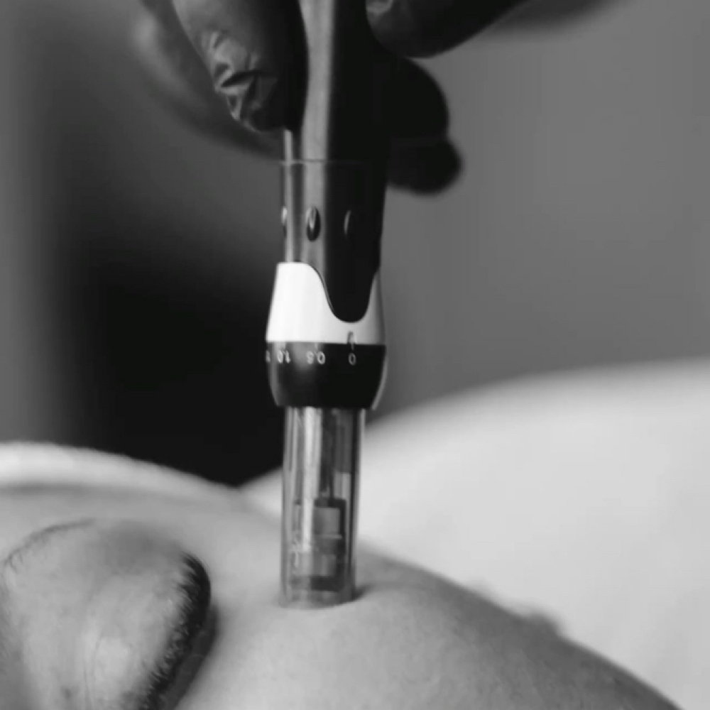 Skin Transformation Series (6) at Moonlit Beauty By T in Eagle, ID