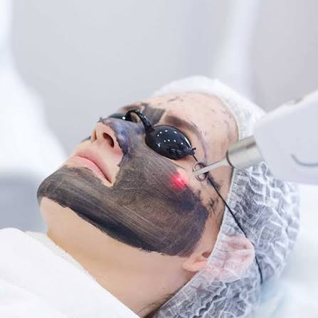 Carbon Facial at Pattyb Wellness in Bellmore, NY
