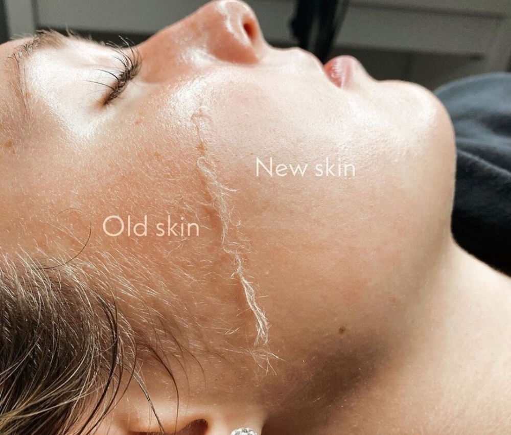 Dermaplaning Add On (Not A Facial) at Ellevate Skincare in Boise, ID