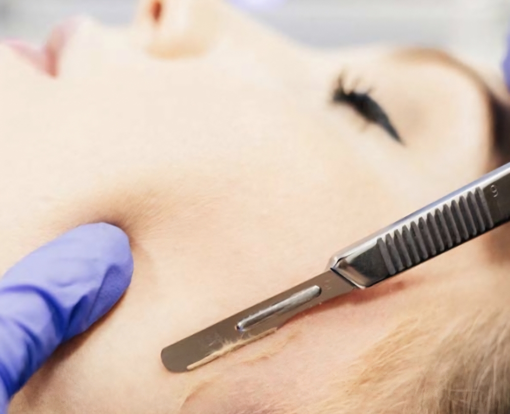 Express Dermaplane Facial