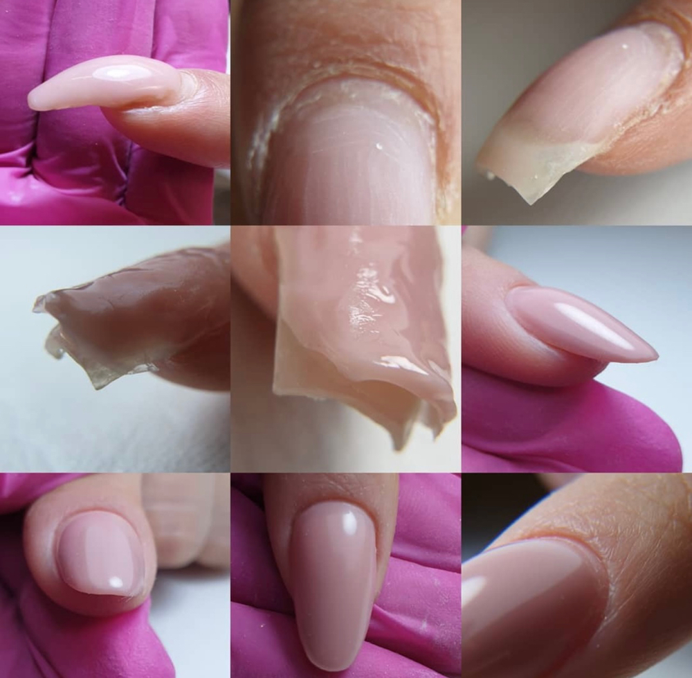 + Nail Repair | Two Nails