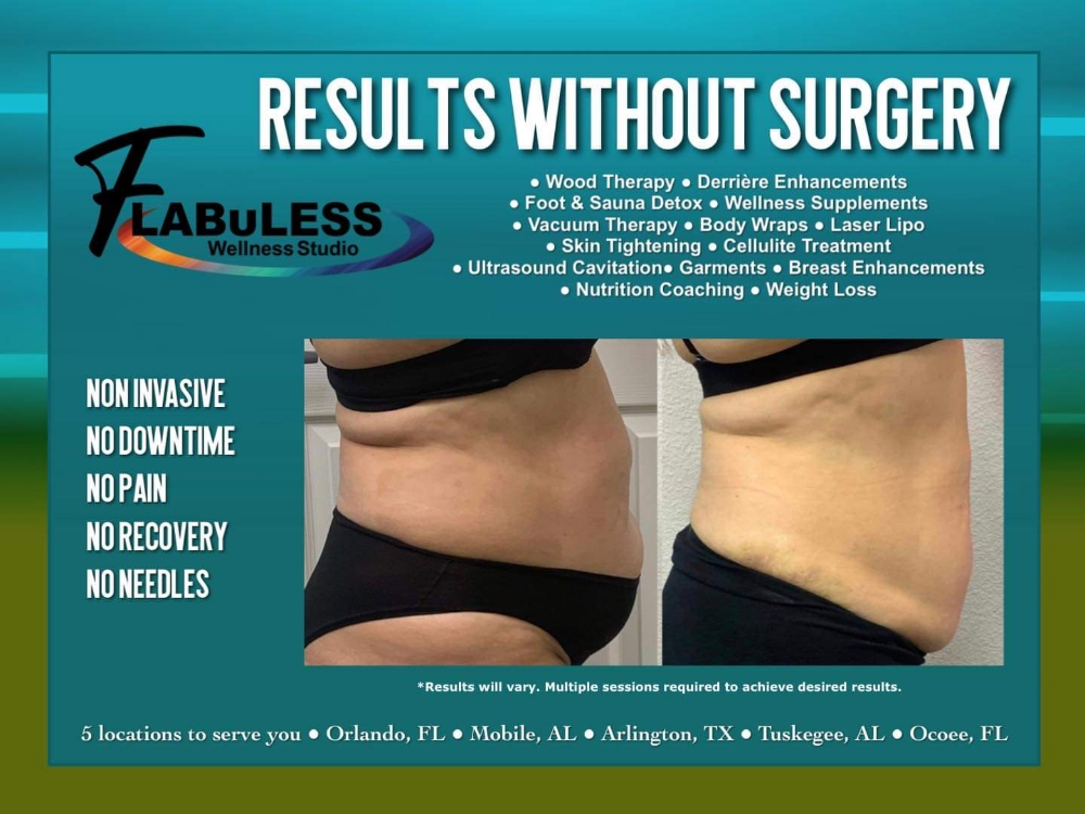 Groupon 4D 360SlimDown (Prepaid)