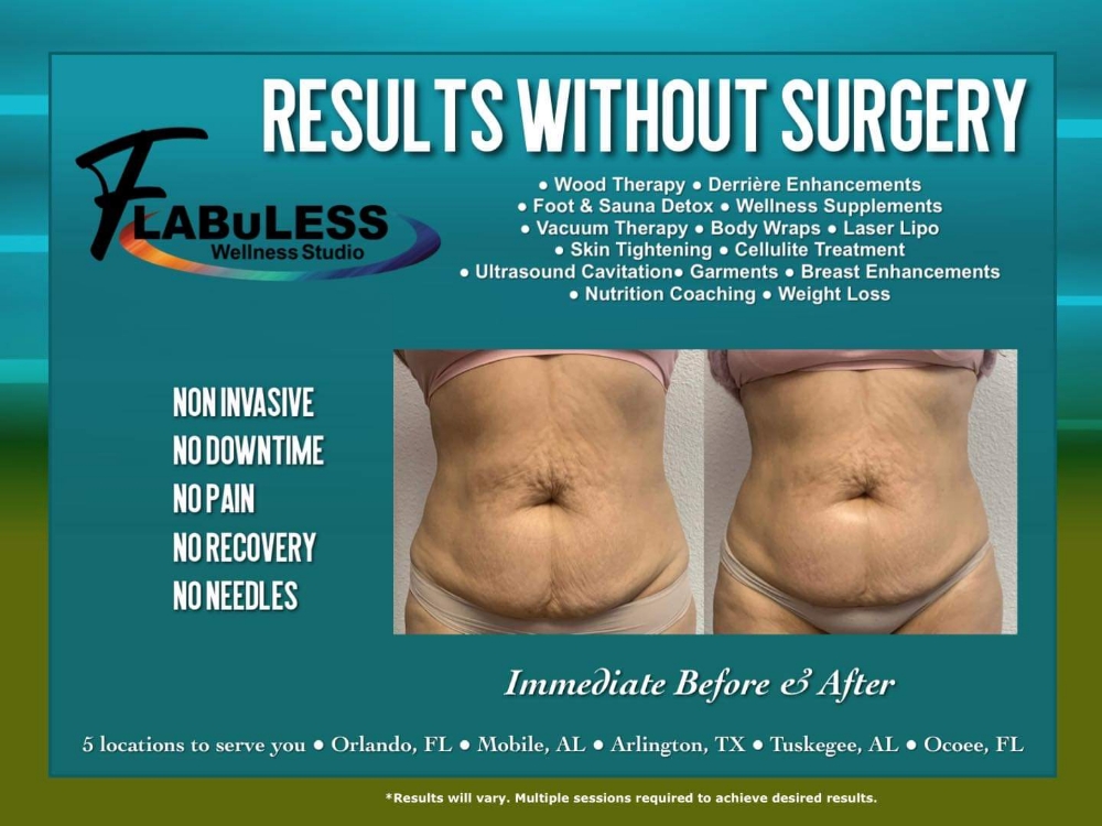 FLABuLESS VIP Models Only