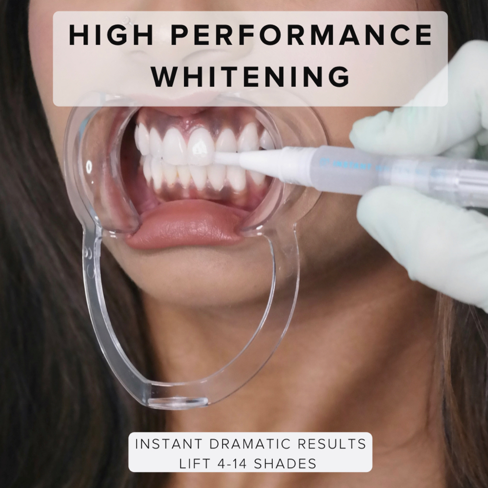 Professional Teeth Whitening