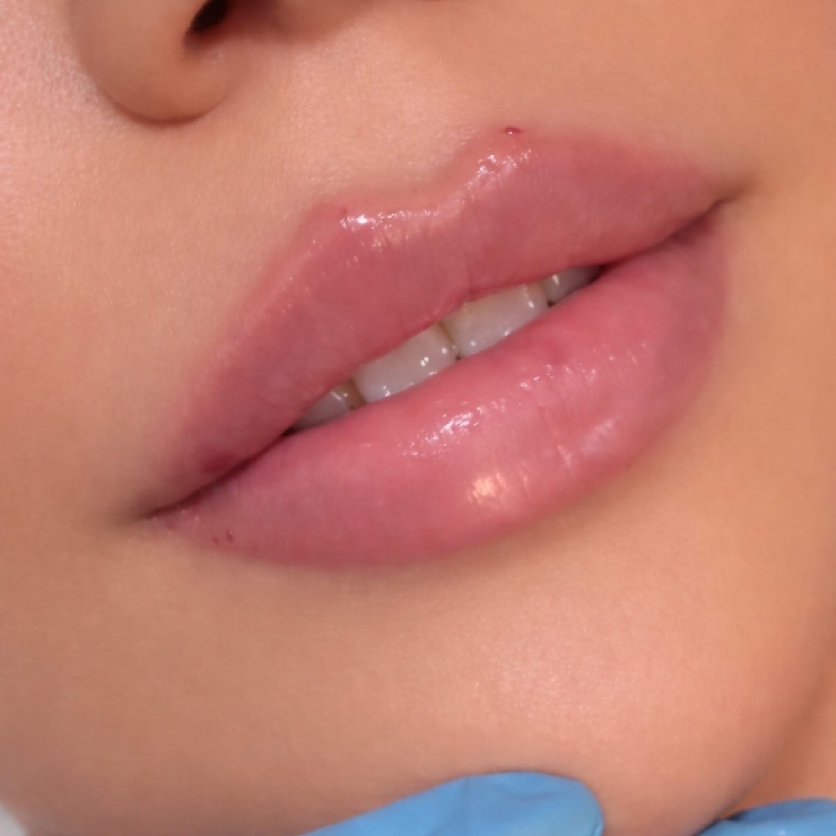 Russian Lips 1.2ML at Gold Stone Beauty in mcallen, TX