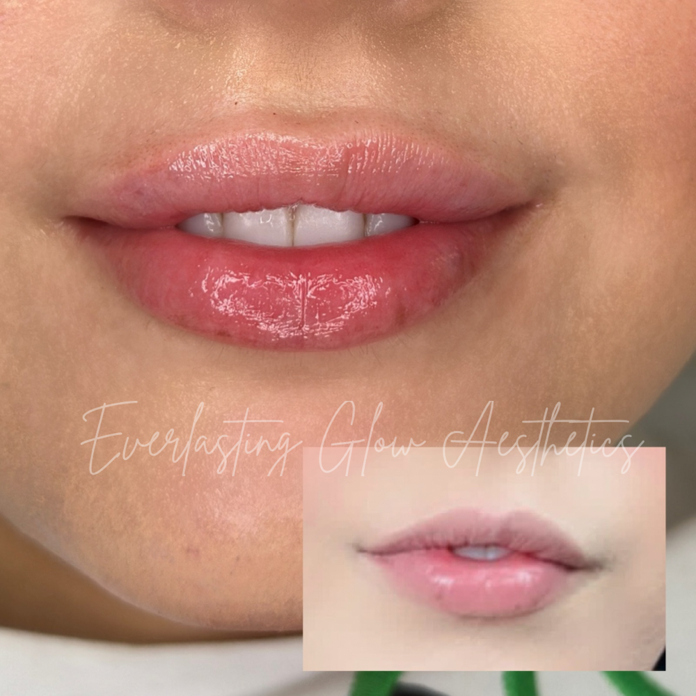 Mini Lip Plump (.5ml)