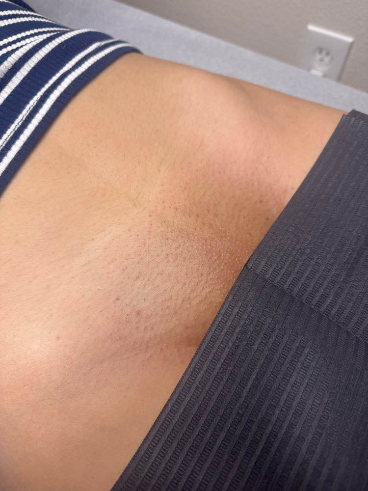 Brazilian+Butt Strip