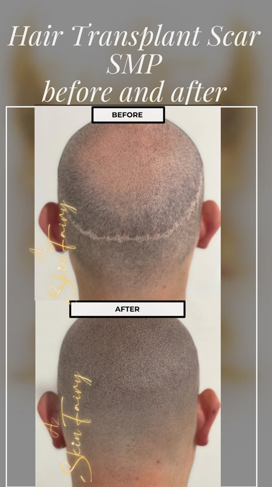 SMP Consultation at AZ SKIN FAIRY in Chandler, AZ