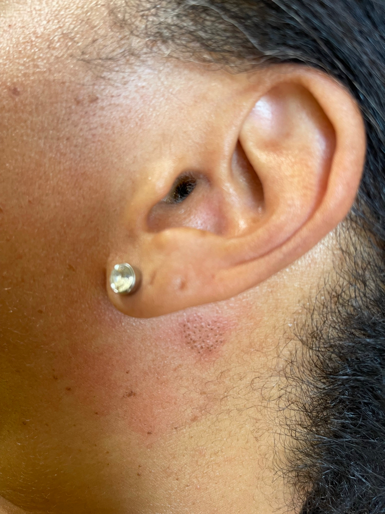 Patch Test