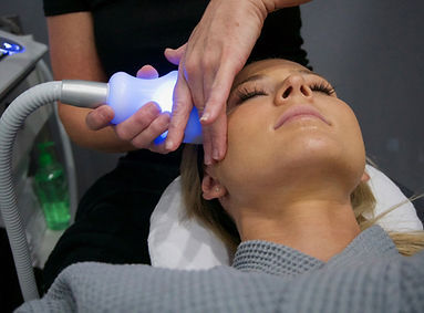 1 CryoFacial Session