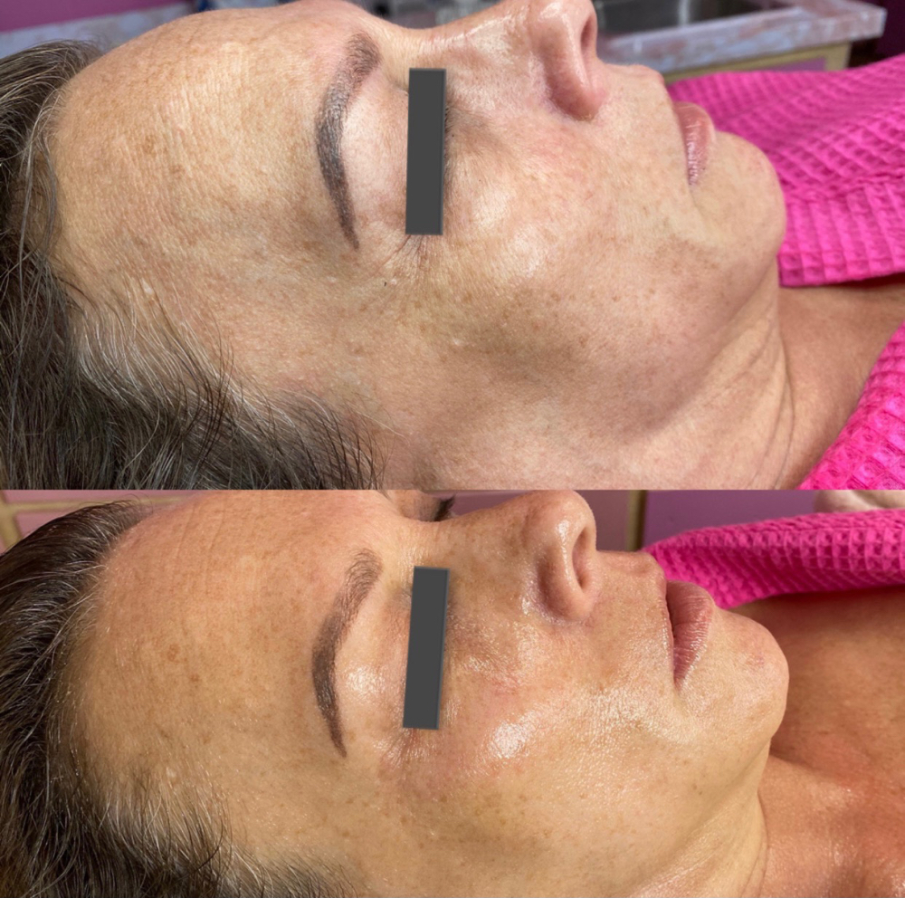 New Member-Rejuvenate Membership