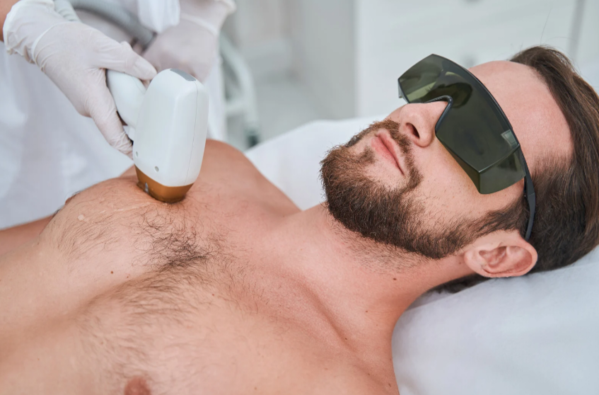 Laser Hair Chest