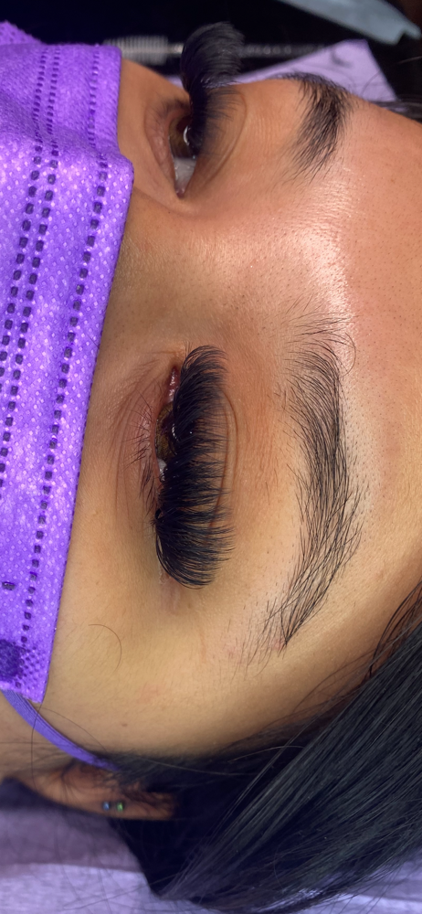 Mega Volume Fill