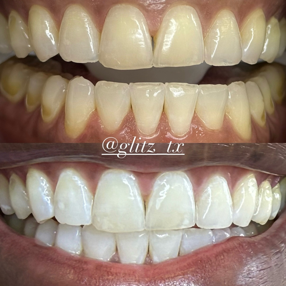 SENSITIVITY PACKAGE at Glitz_Tx in San Antonio, TX