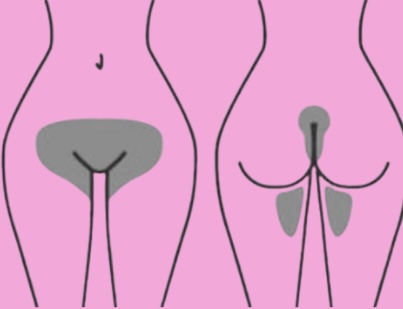Brazilian Wax