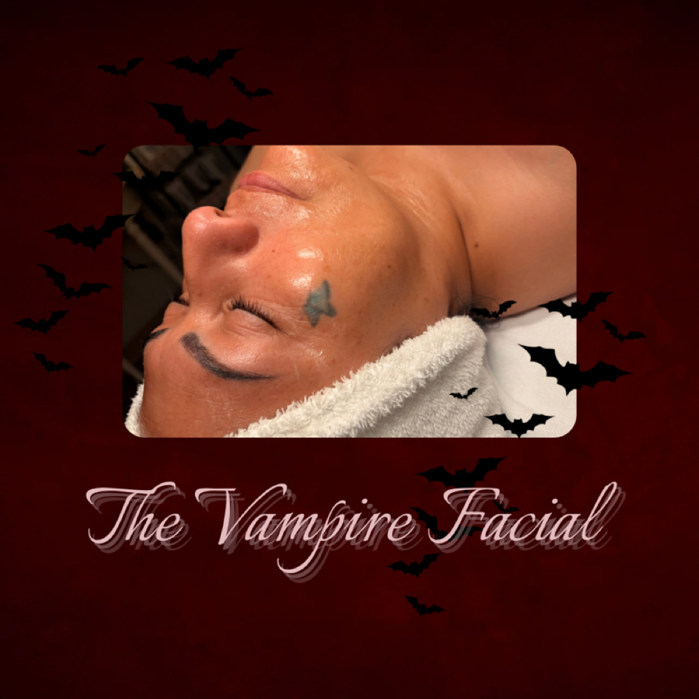 The Vampire Facial at Aesthetics By Chelle in Mesa, AZ