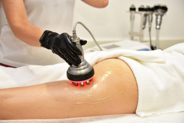 Cellulite Reduction Treatment