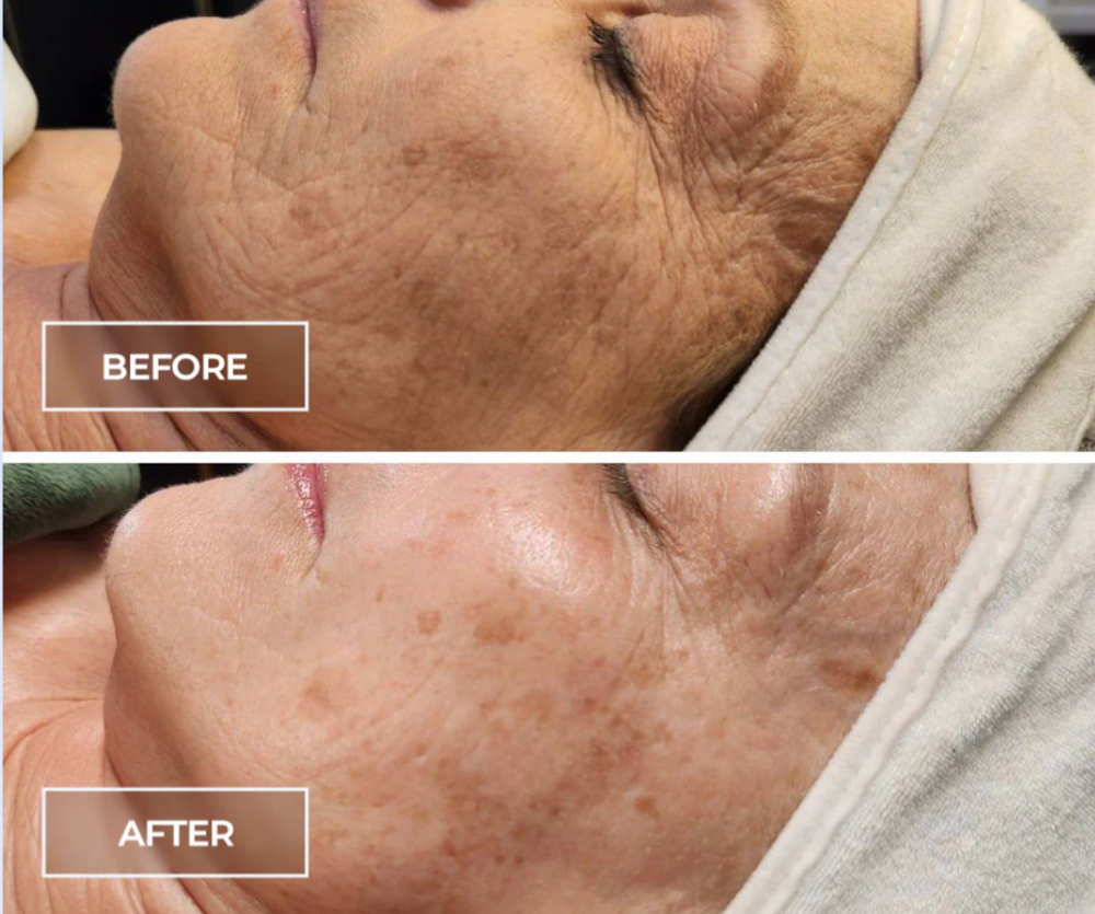 Switch Cell Revitalization at St Florian’s Soap and Spa in Coeur d’Alene, ID