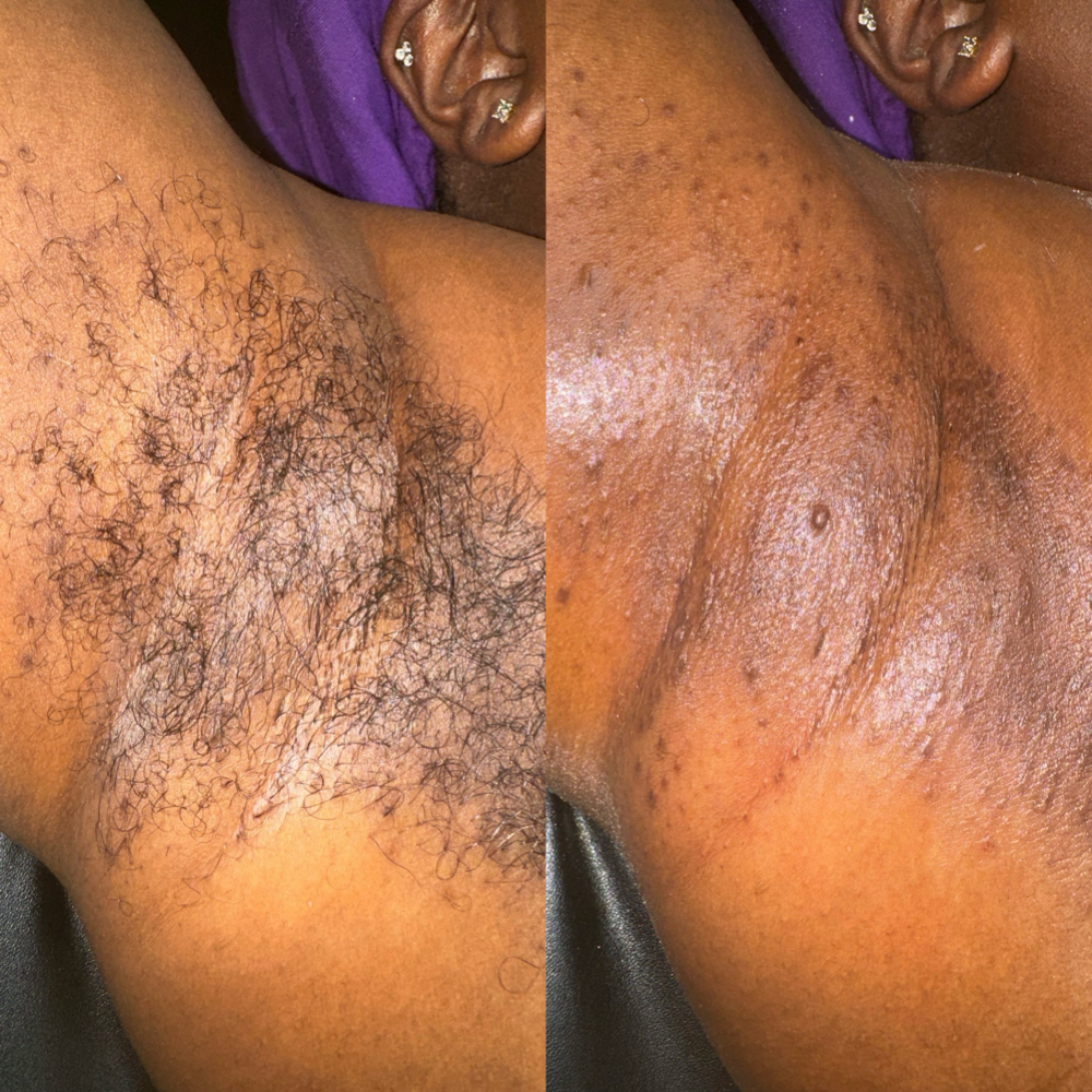Underarms at CM BEAUTY BAR in Housto, TX