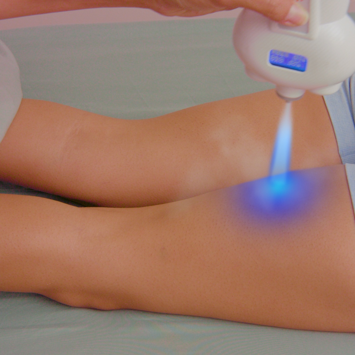 Thigh & Hip Sculpt Cryotherapy