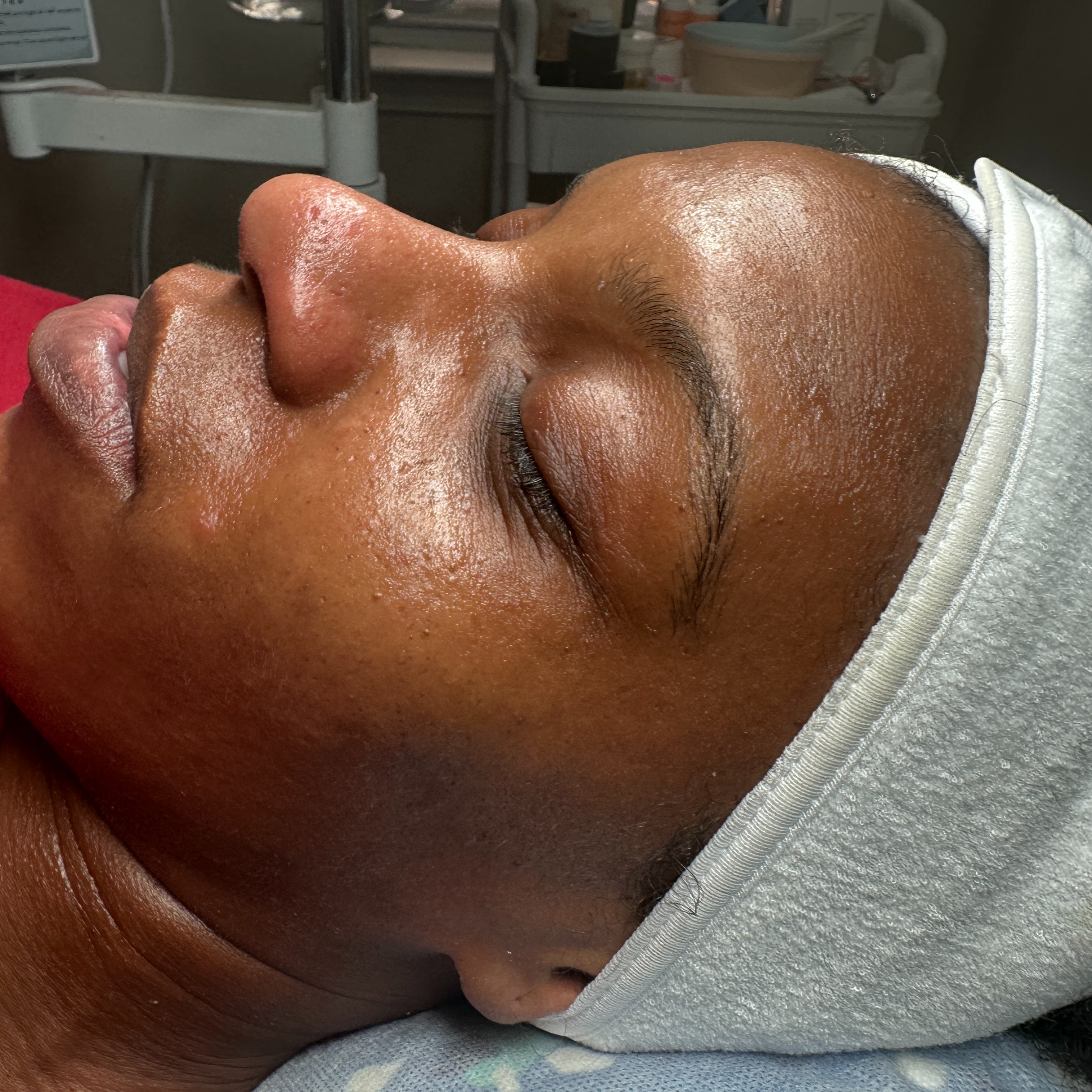 Skinterrogation: The First Facial at Skin Rehab in Charlotte, NC
