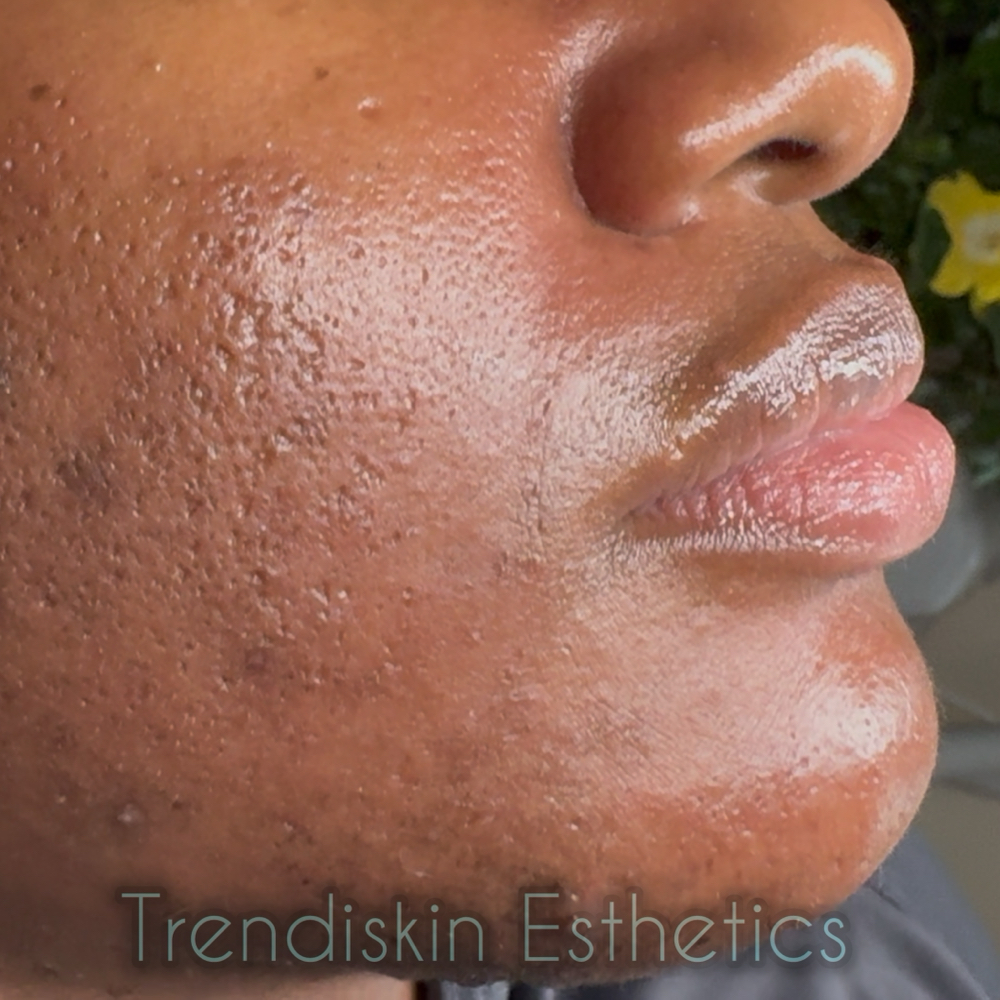 Herbal Green Peel