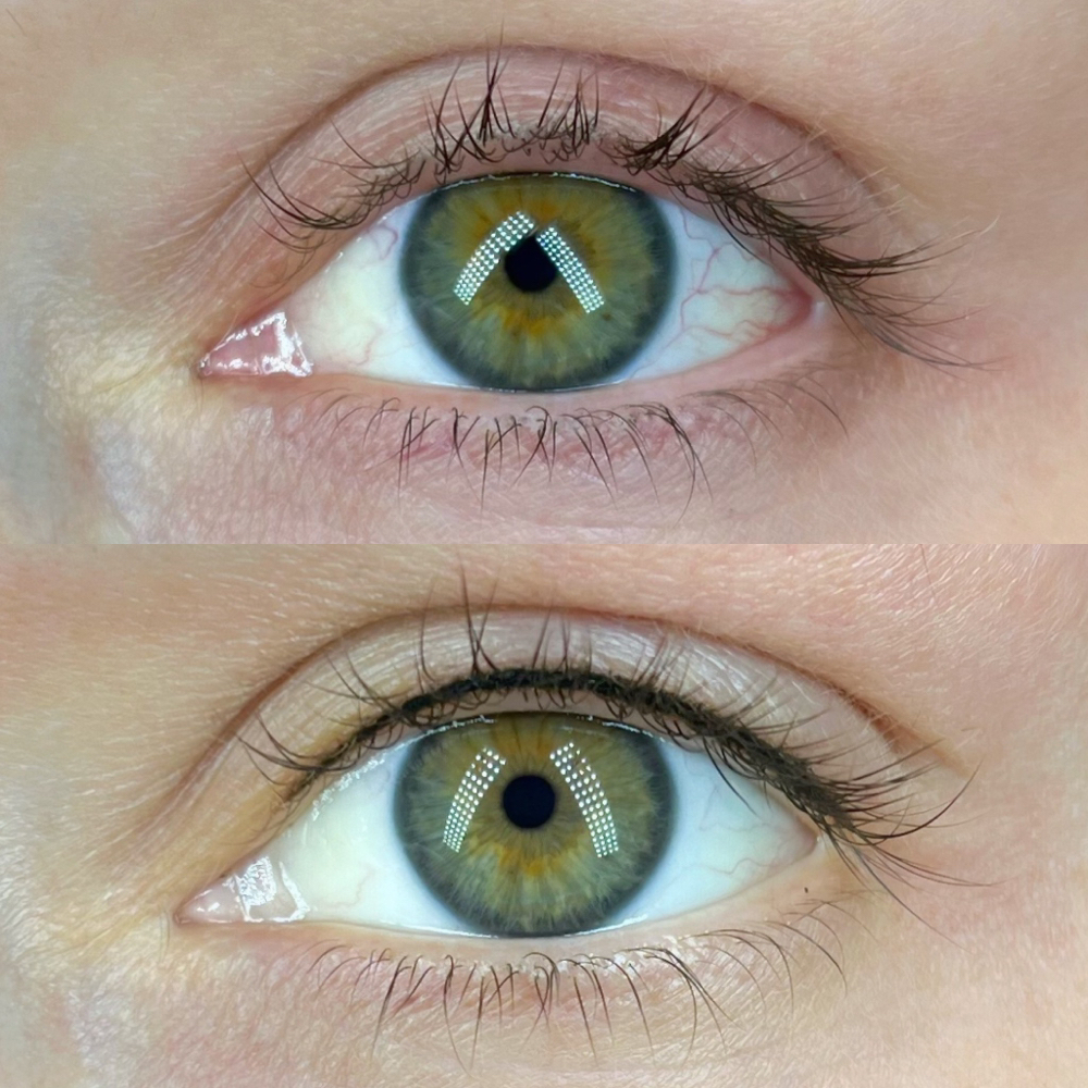 Lash Line Enhancement