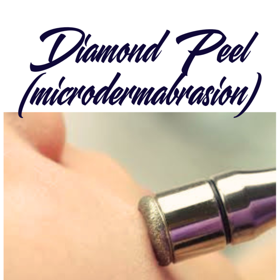 Diamond Peel at Royal Esthetics & Wellness in Oro Valley, AZ