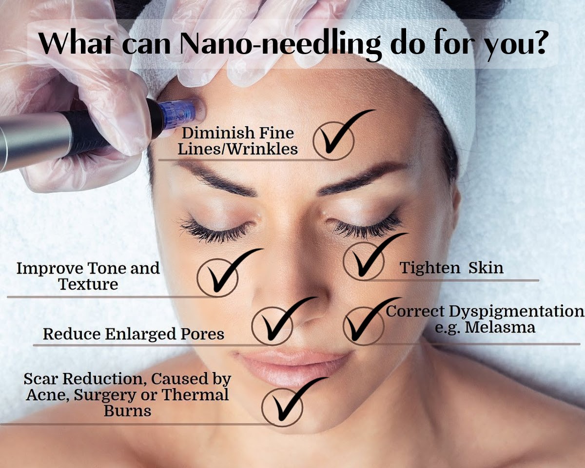 Nano Needling