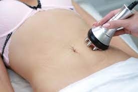 Radio Frequency Body or Facial