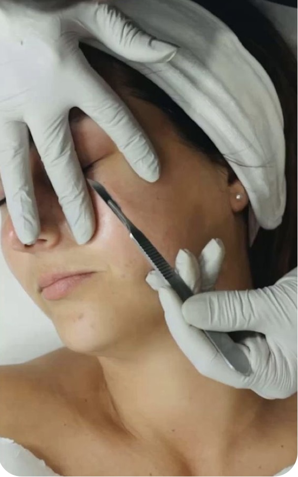 Dermaplaning