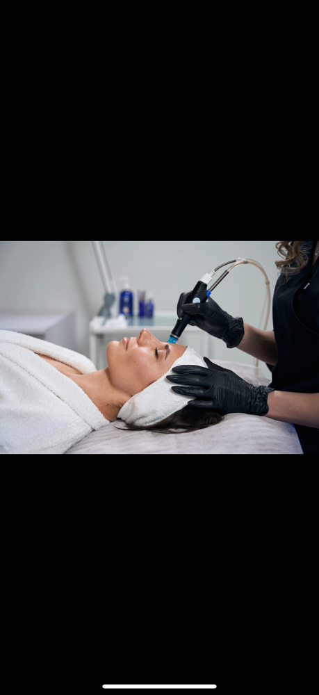 Hydrodermabrasion at Taylor Rose Aesthetics in Altoona, WI