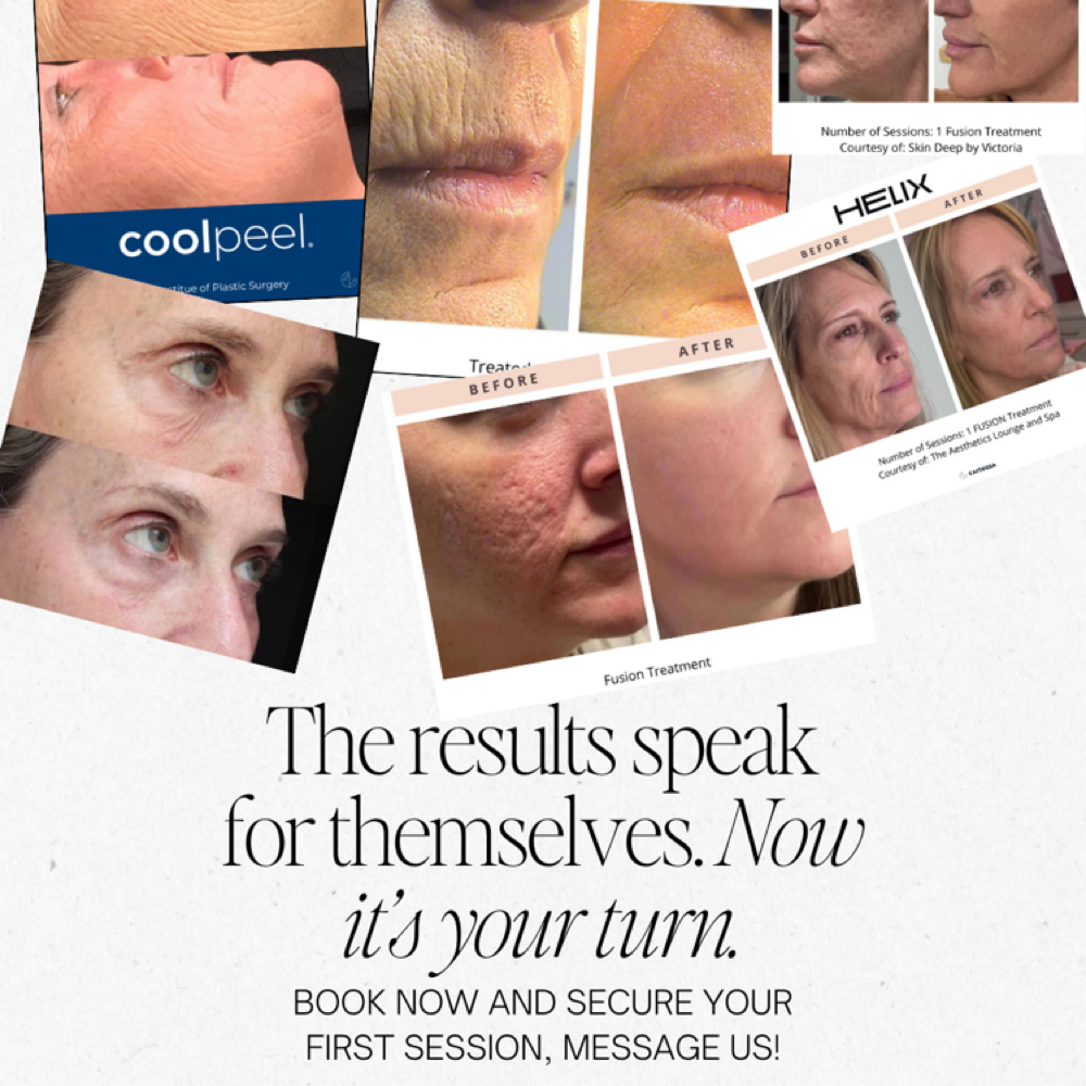 HELIX Laser Treatments at Reilly Rae Aesthetics in Wyandotte, MI