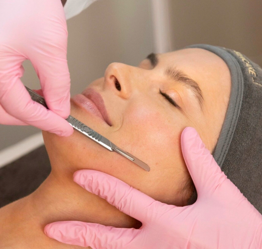 Dermal Resurfacing