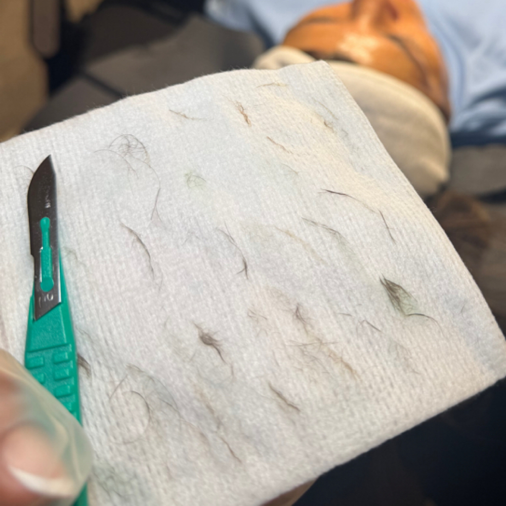 Dermaplaning at Darode Beauty Studio in Eagle Pass Tx, TX