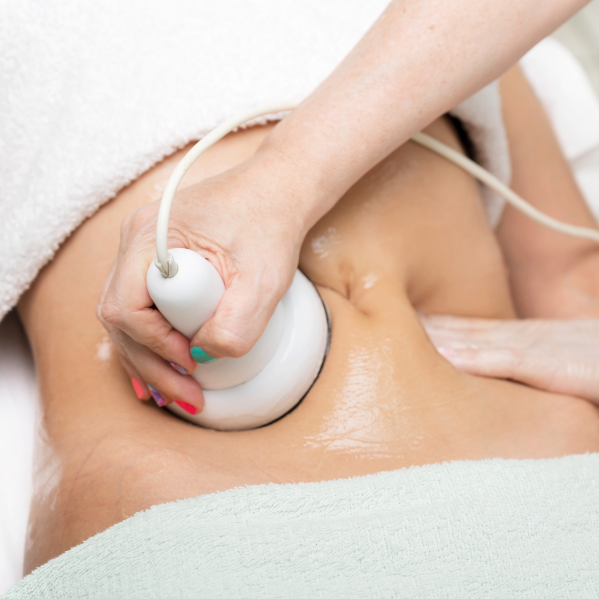 Cool Sculpting  (1 head) at Zoya Wellness Center in Rolling Meadows, IL