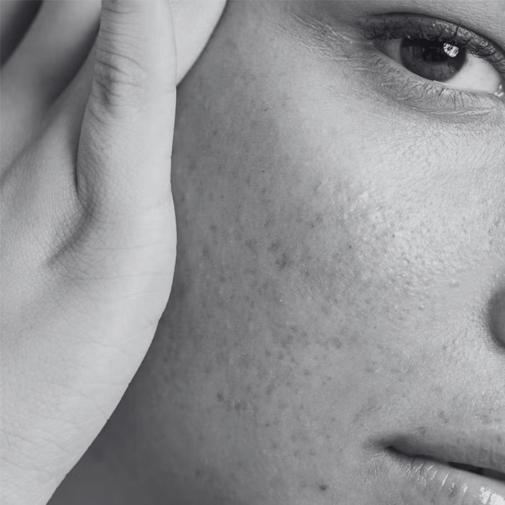 Skin Tightening – Small Area at Kietre Wellness & Aesthetics in North Las Vegas, NV