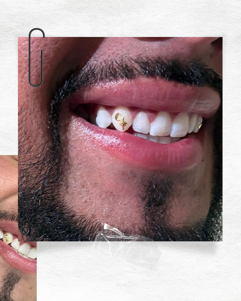 Tooth Gems at Rooted Rituals Esthetics Co. in North Ogden, UT