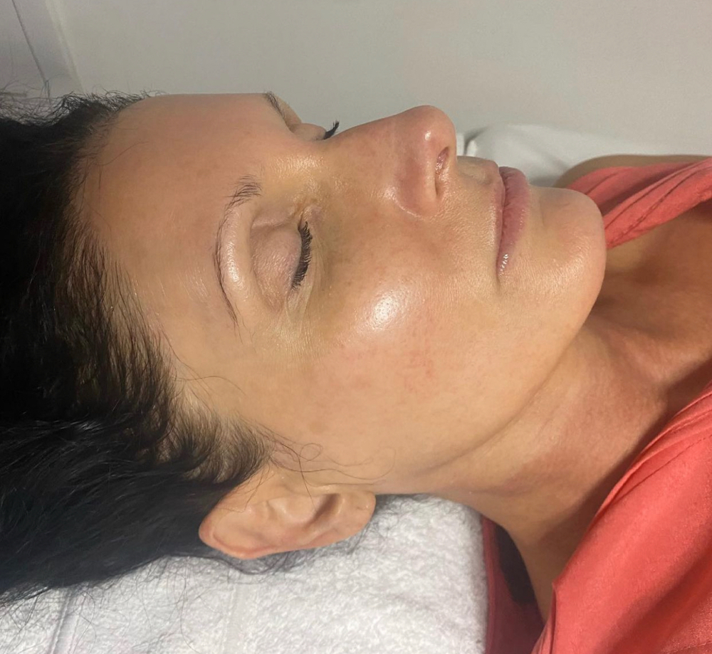 Anti-aging Facial