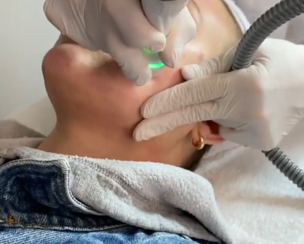 Fully Loaded Photofacial