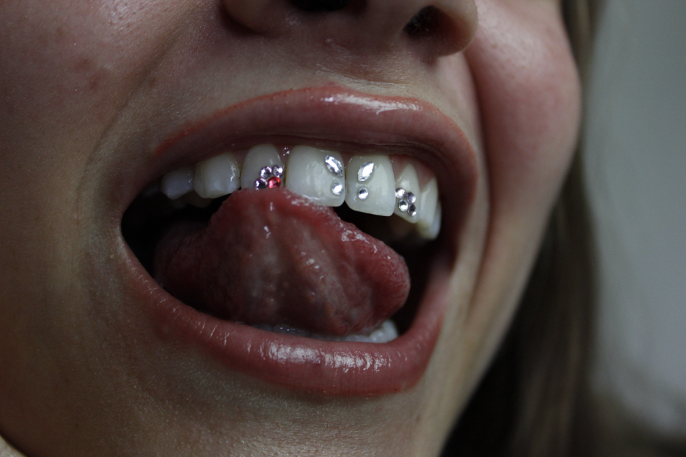 Tooth Gem
