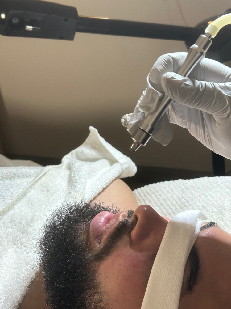 Sky Micro Glow at Sky Aesthetics & Wellness Studio in East Hanover, NJ