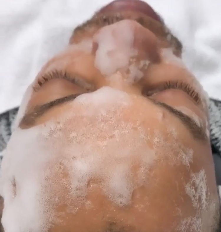 Lewi’s Oxygen Facial