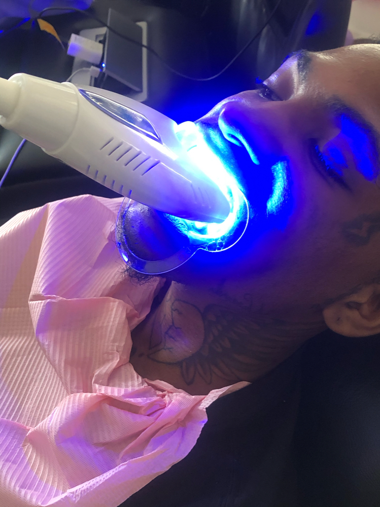 1 Hr Teeth Whitening