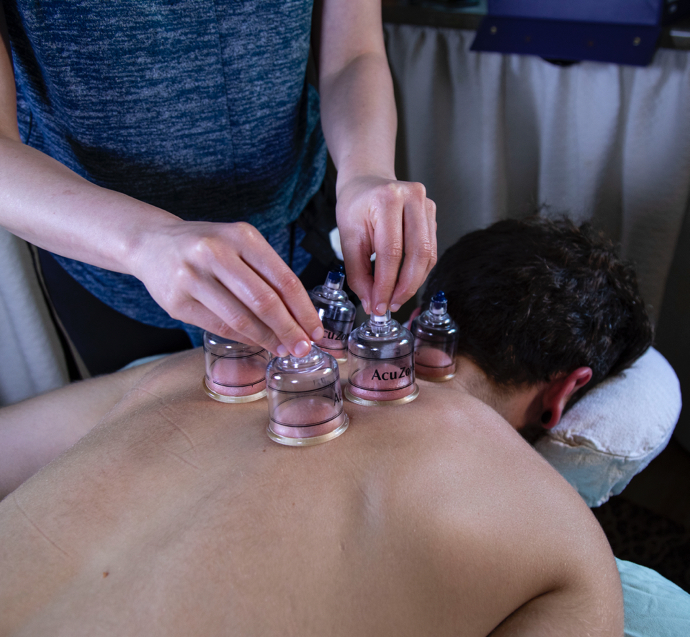 60 Minute Cupping Massage