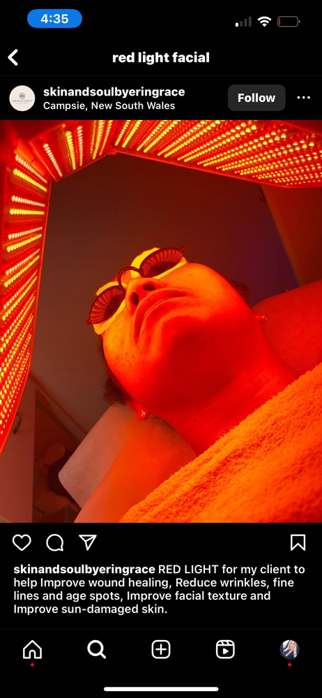 Red light therapy RLT