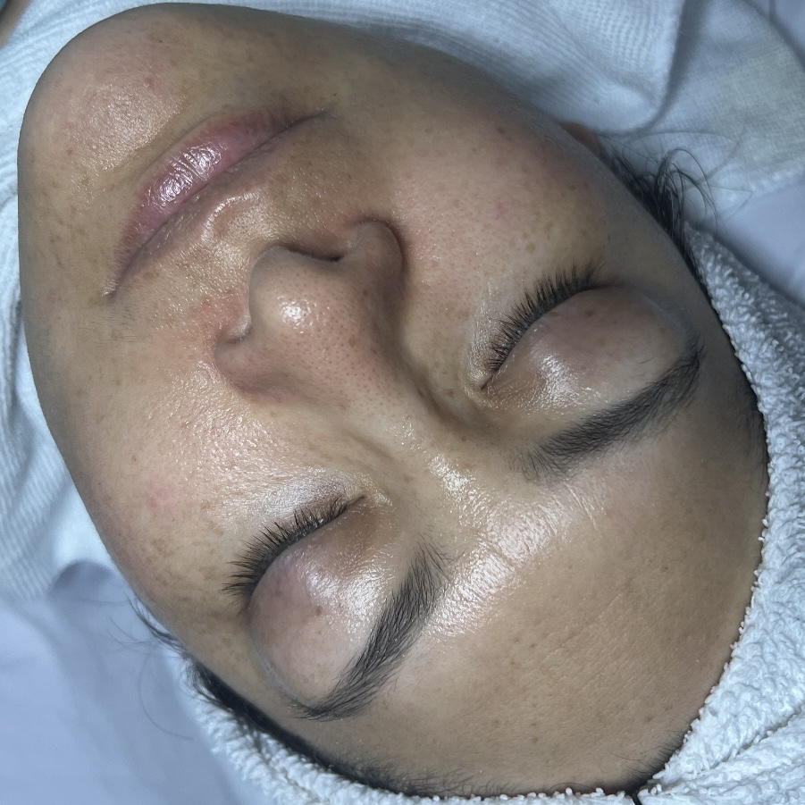 Basic Facial