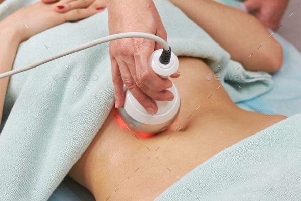 Radio Frequencey Therapy