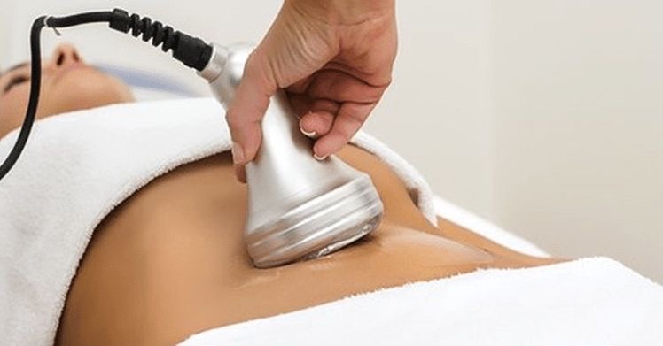 Cavitation