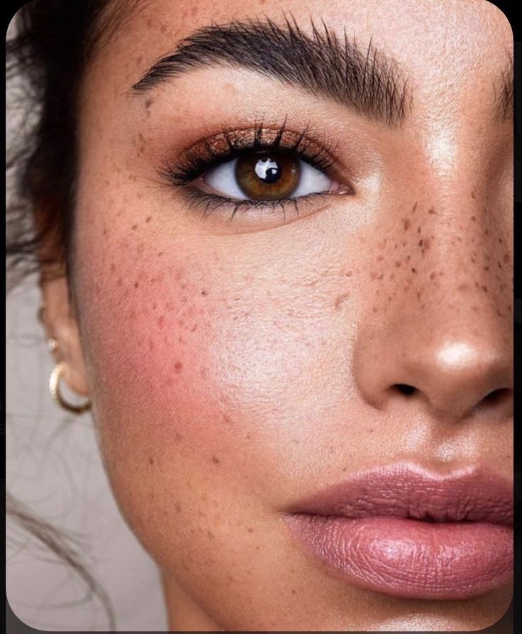 Sun Kissed Freckles